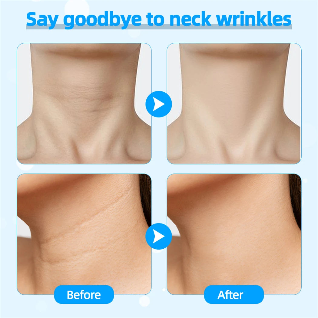 LED Face & Neck Lifting Massager – 4 Color Light Therapy & Skin Tightening Device